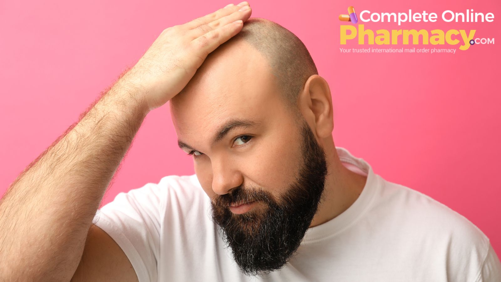 Men's Hair Loss Problem: Causes, Diagnosis, and Treatments