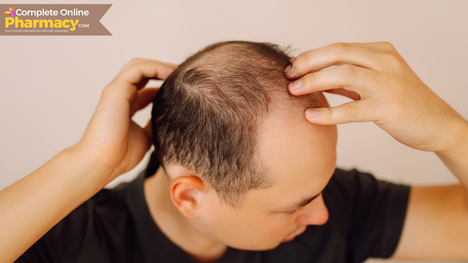 Propecia for Hair Loss: What Results Can You Expect?