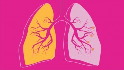 4 breathing exercises for COPD