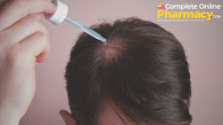 What to Expect When Using Propecia 1mg Tablets for Hair Regrowth