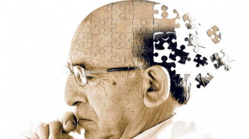 Alzheimer's Disease